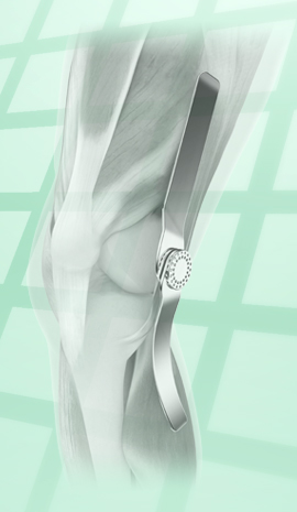 3D-Darstellung Knie für ein medizinisches elearning Medizintechnik und Pharma
