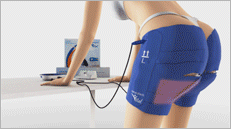 Elektrostimulationstherapie bei Belastungsinkontinenz Lymphsystem 3D-Animation Medizin/Pharma