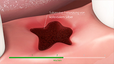 3D-Animation Dental: gleichmige Wundheilung im Mund