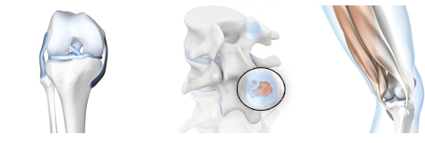 Wirbelsäule Bandscheibe Knie medizinische 3D-Visualisierungen und Illustrationen Knochen Anatomie Orthopdie 3D-Animation