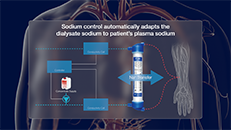 3D-Animationsfilm Medizintechnik H�modialyse
